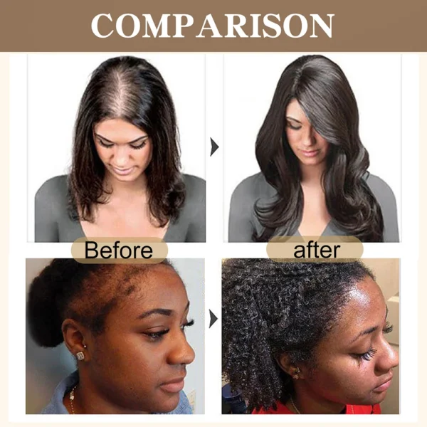 kf-Sff94dff0911d407a94a90feff0b29130f